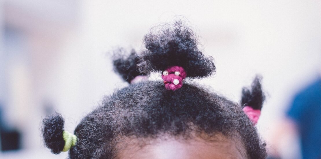 Trichotillomania Hair pulling Coping strategies Hair loss disorder Behavioral therapy Understanding trichotillomania Compulsive behavior Hair pulling triggers Treatment options Psychological condition.